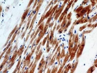 Immunohistochemistry: Troponin I Type 3 (cardiac) Antibody (2C9) - Azide and BSA Free [NBP2-80995]