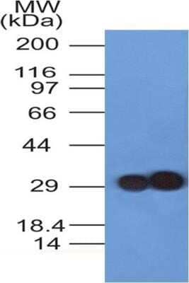 Western Blot: Troponin I Type 3 (cardiac) Antibody (2C9)Azide and BSA Free [NBP2-80995]