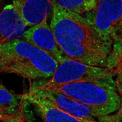 Immunocytochemistry/ Immunofluorescence: Troponin I Type 3 (cardiac) Antibody [NBP2-33463]