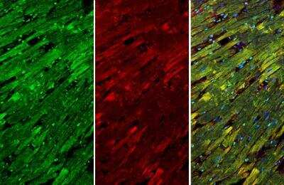 Immunohistochemistry-Paraffin: Troponin I Type 3 (cardiac) Antibody [NBP2-20734]