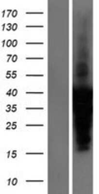 Western Blot: Troponin I Type 3 (cardiac) Overexpression Lysate [NBP2-11142]