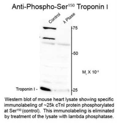 Western Blot: Troponin I Type 3 (cardiac) [p Ser150] Antibody [NBP2-29526]