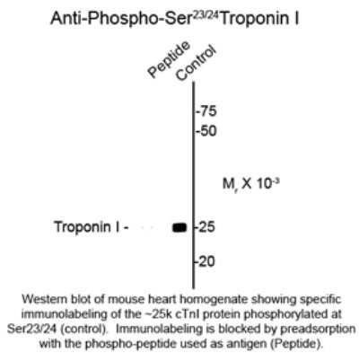 Western Blot: Troponin I Type 3 (cardiac) [p Ser23, p Ser24] Antibody [NBP2-29525]