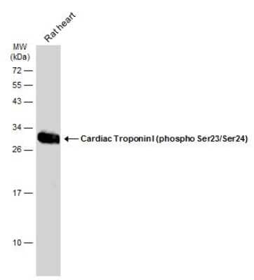 Western Blot: Troponin I Type 3 (cardiac) [p Ser24, p Ser23] Antibody [NBP3-13325]