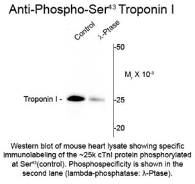 Western Blot: Troponin I Type 3 (cardiac) [p Ser43] Antibody [NBP2-29515]