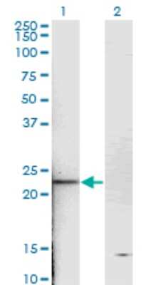 Western Blot: Troponin I type 2 (fast skeletal) Antibody (2D5) [H00007136-M05]