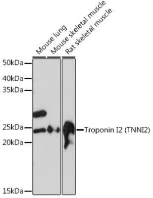 Western Blot: Troponin I type 2 (fast skeletal) Antibody (2H7S10) [NBP3-16474]