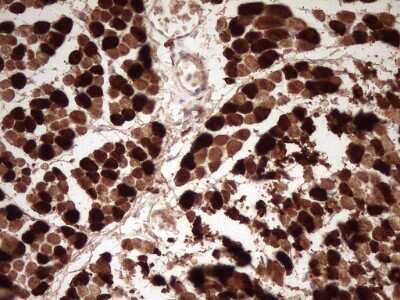 Immunohistochemistry: Troponin I type 2 (fast skeletal) Antibody (OTI3A11) [NBP2-46171]