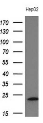Western Blot: Troponin I type 2 (fast skeletal) Antibody (OTI3A11) [NBP2-46171]