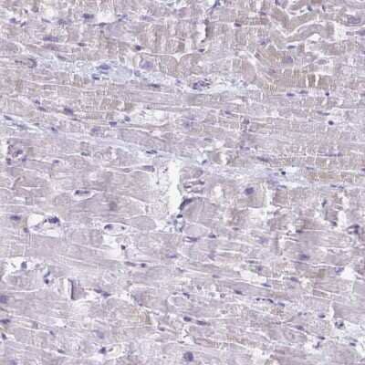 Immunohistochemistry-Paraffin: Troponin I type 2 (fast skeletal) Antibody [NBP2-38775]