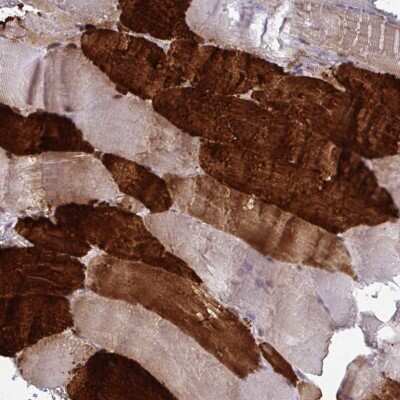 Immunohistochemistry-Paraffin: Troponin I type 2 (fast skeletal) Antibody [NBP2-38775]