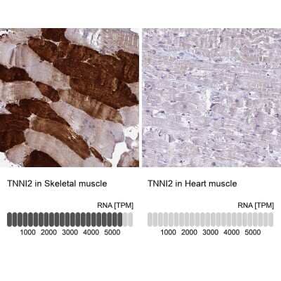 Immunohistochemistry-Paraffin: Troponin I type 2 (fast skeletal) Antibody [NBP2-38775]