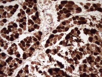 Immunohistochemistry: Troponin I type 2 (fast skeletal) Antibody (OTI3A11) - Azide and BSA Free [NBP2-74640]