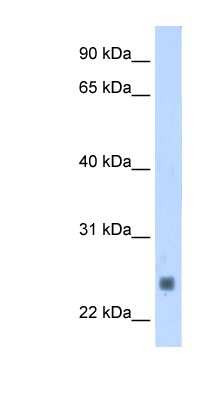 Western Blot: Troponin I type 2 (fast skeletal) Antibody [NBP1-57842]