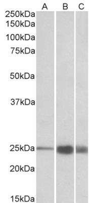 Western Blot: Troponin I type 2 (fast skeletal) Antibody [NBP2-26201]