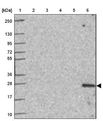 Western Blot: Troponin I type 2 (fast skeletal) Antibody [NBP2-38775]