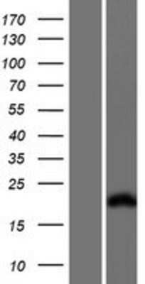 Western Blot: Troponin I type 2 (fast skeletal) Overexpression Lysate [NBP2-10871]