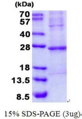 SDS-PAGE: Recombinant Human Troponin I type 2 (fast skeletal) His Protein [NBP2-22893]