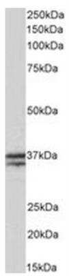 Western Blot: Troponin T type 1 (slow skeletal) Antibody [NBP2-26095]