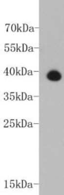 Western Blot: Troponin T Type 2 (cardiac) Antibody (5-C7) [NBP2-67211]