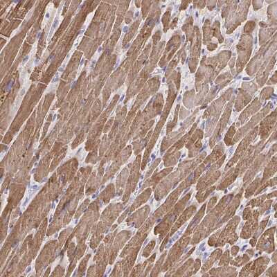 Immunohistochemistry-Paraffin: Troponin T Type 2 (cardiac) Antibody [NBP1-88069]