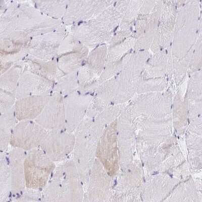 Immunohistochemistry-Paraffin: Troponin T Type 2 (cardiac) Antibody [NBP1-88069]