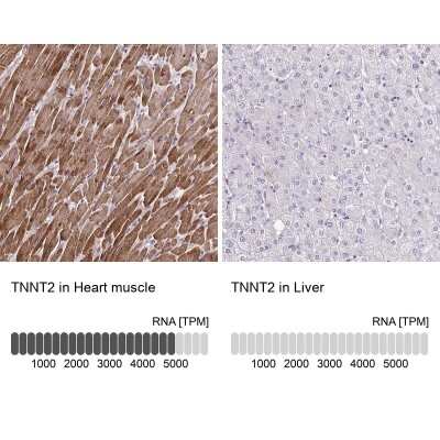 Immunohistochemistry-Paraffin: Troponin T Type 2 (cardiac) Antibody [NBP1-88070]