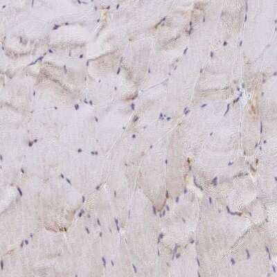 Immunohistochemistry-Paraffin: Troponin T Type 2 (cardiac) Antibody [NBP1-88070]