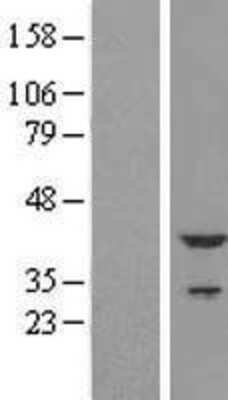 Western Blot: Troponin T Type 2 (cardiac) Overexpression Lysate [NBL1-17181]