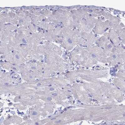 Immunohistochemistry-Paraffin: Troponin T Type 3 (fast skeletal) Antibody [NBP1-92534]