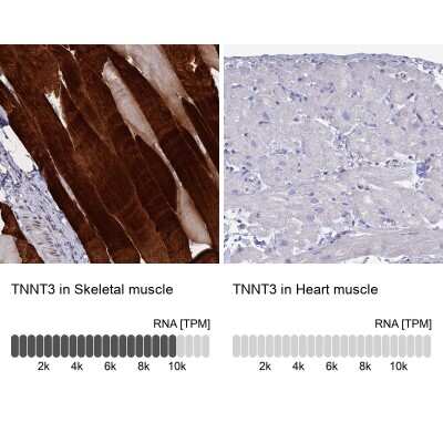 Immunohistochemistry-Paraffin: Troponin T Type 3 (fast skeletal) Antibody [NBP1-92534]