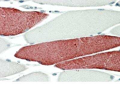 Immunohistochemistry-Paraffin: Troponin T Type 3 (fast skeletal) Antibody [NBP2-26199]