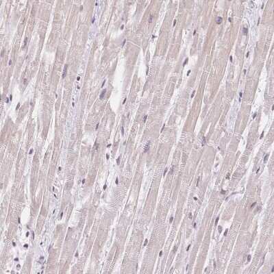 Immunohistochemistry-Paraffin: Troponin T Type 3 (fast skeletal) Antibody [NBP2-49237]