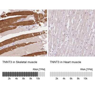 Immunohistochemistry-Paraffin: Troponin T Type 3 (fast skeletal) Antibody [NBP2-49237]