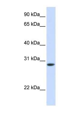 Western Blot: Troponin T Type 3 (fast skeletal) Antibody [NBP1-56340]