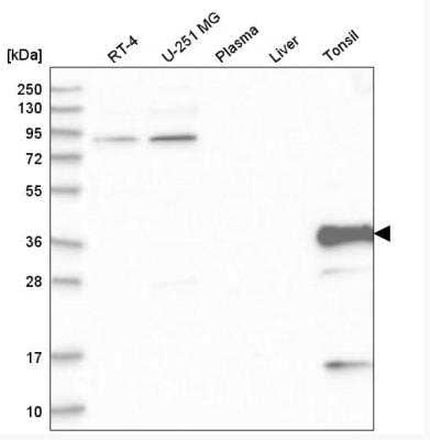 Western Blot: Troponin T Type 3 (fast skeletal) Antibody [NBP1-92534]