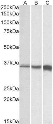 Western Blot: Troponin T Type 3 (fast skeletal) Antibody [NBP2-26199]