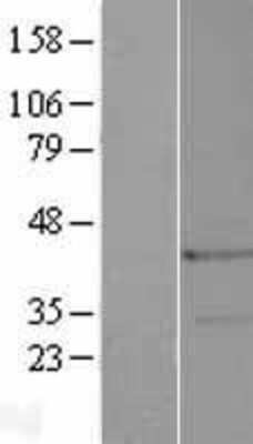 Western Blot: Troponin T Type 3 (fast skeletal) Overexpression Lysate [NBP2-04317]