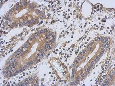 Immunohistochemistry-Paraffin: Troponin T type 1 (slow skeletal) Antibody [NBP1-32748]