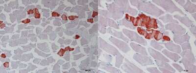 Immunohistochemistry-Paraffin: Troponin T type 1 (slow skeletal) Antibody [NBP1-32748]