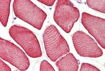 Immunohistochemistry-Paraffin: Troponin T type 1 (slow skeletal) Antibody [NBP2-26095]