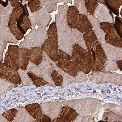 Immunohistochemistry-Paraffin: Troponin T type 1 (slow skeletal) Antibody [NBP2-38855]