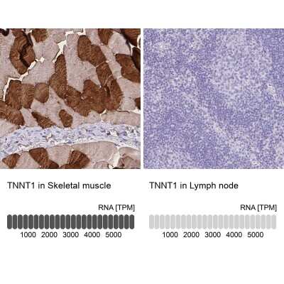 Immunohistochemistry-Paraffin: Troponin T type 1 (slow skeletal) Antibody [NBP2-38855]