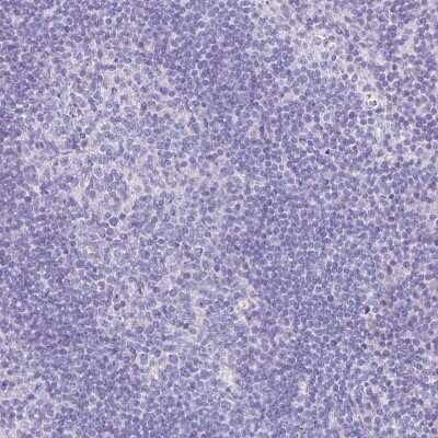 Immunohistochemistry-Paraffin: Troponin T type 1 (slow skeletal) Antibody [NBP2-38855]