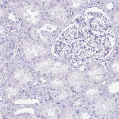 Immunohistochemistry-Paraffin: Troponin T type 1 (slow skeletal) Antibody [NBP2-38855]
