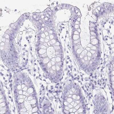Immunohistochemistry-Paraffin: Troponin T type 1 (slow skeletal) Antibody [NBP2-38855]