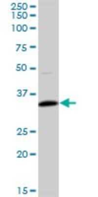 Western Blot: Troponin T type 1 (slow skeletal) Antibody [H00007138-B01P]