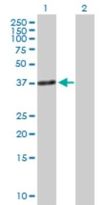 Western Blot: Troponin T type 1 (slow skeletal) Antibody [H00007138-B01P]