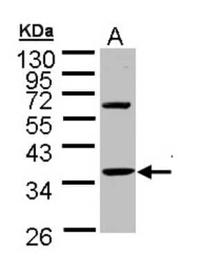 Western Blot: Troponin T type 1 (slow skeletal) Antibody [NBP1-32748]