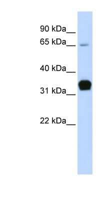 Western Blot: Troponin T type 1 (slow skeletal) Antibody [NBP1-54820]